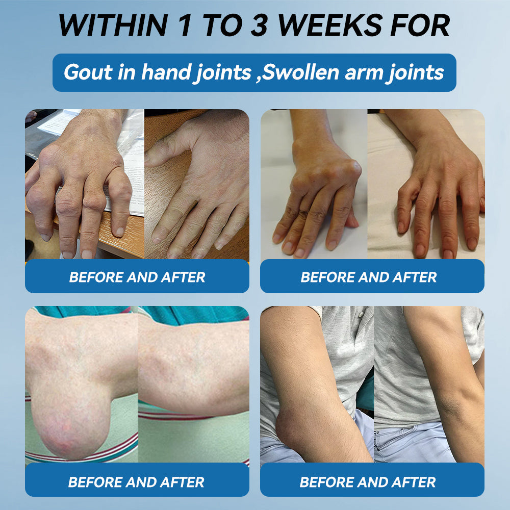 𝘾𝙧𝙤𝙖𝙞𝙚® BPC-157 Joint Healing Cream🦴Treats Arthritis, Neuropathy, Rheumatism, Sports Injuries & More🏆