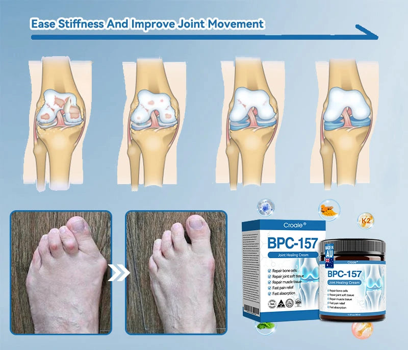 𝘾𝙧𝙤𝙖𝙞𝙚® BPC-157 Joint Healing Cream🦴Treats Arthritis, Neuropathy, Rheumatism, Sports Injuries & More🏆