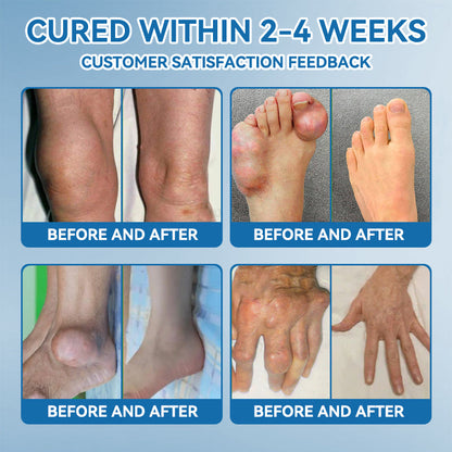 𝘾𝙧𝙤𝙖𝙞𝙚® BPC-157 Joint Healing Cream🦴Treats Arthritis, Neuropathy, Rheumatism, Sports Injuries & More🏆