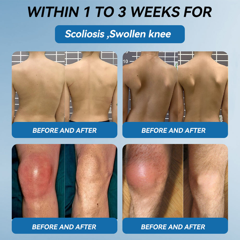 𝘾𝙧𝙤𝙖𝙞𝙚® BPC-157 Joint Healing Cream🦴Treats Arthritis, Neuropathy, Rheumatism, Sports Injuries & More🏆