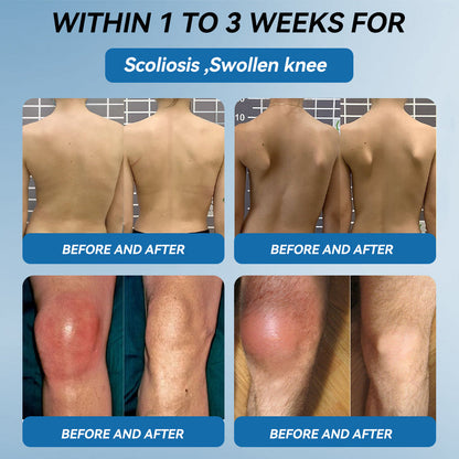 𝘾𝙧𝙤𝙖𝙞𝙚® BPC-157 Joint Healing Cream🦴Treats Arthritis, Neuropathy, Rheumatism, Sports Injuries & More🏆