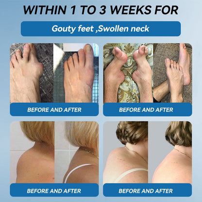 𝘾𝙧𝙤𝙖𝙞𝙚® BPC-157 Joint Healing Cream🦴Treats Arthritis, Neuropathy, Rheumatism, Sports Injuries & More🏆
